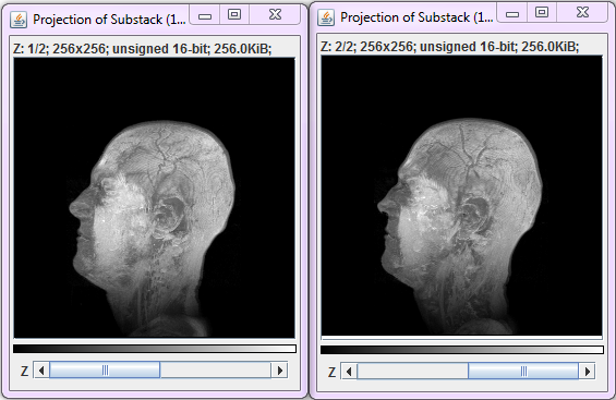 grouped_z_stack.png grouped_z_stack.png