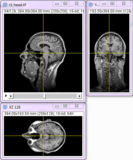 orthogonal_views_example.png orthogonal_views_example.png